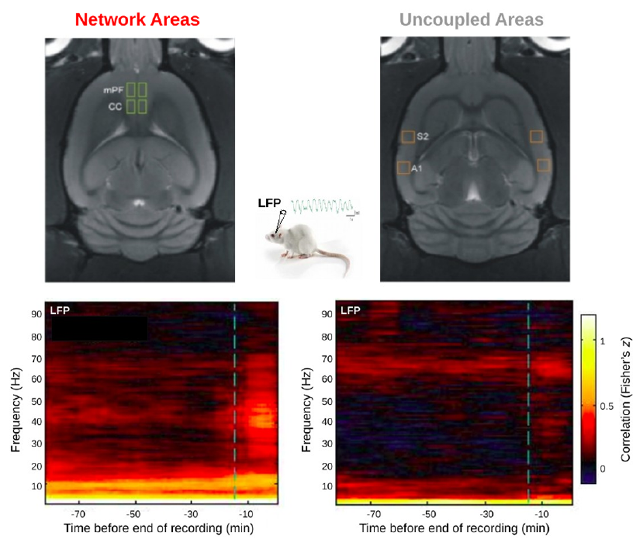 anestesia-4